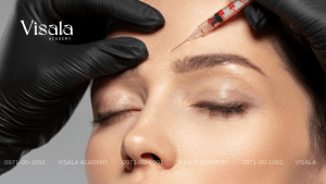 5 Loại Filler Phổ Biến